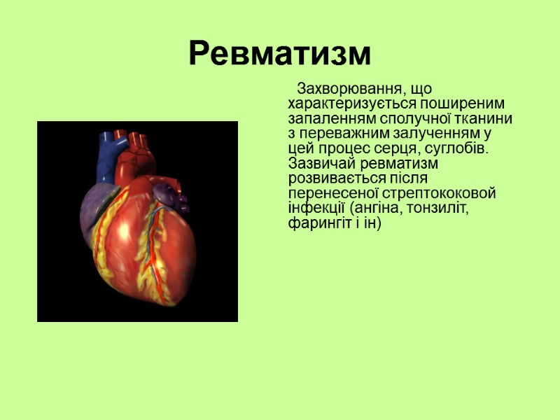 Ревматизм         Захворювання, що характеризується поширеним запаленням